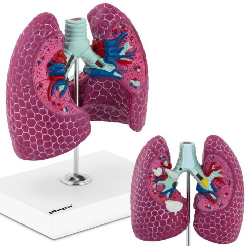 Model anatomiczny 3D płuca człowieka ze zmianami chorobowymi Model anatomiczny 3D płuca człowieka ze zmianami chorobowymi